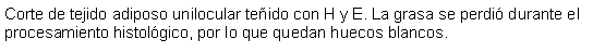 Cuadro de texto: Corte de tejido adiposo unilocular teido con H y E. La grasa se perdi durante el procesamiento histolgico, por lo que quedan huecos blancos.