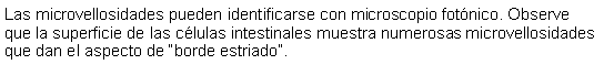 Cuadro de texto: Las microvellosidades pueden identificarse con microscopio fotnico. Observe que la superficie de las clulas intestinales muestra numerosas microvellosidades que dan el aspecto de borde estriado. 