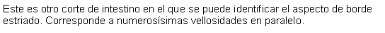 Cuadro de texto: Este es otro corte de intestino en el que se puede identificar el aspecto de borde estriado. Corresponde a numerossimas vellosidades en paralelo. 