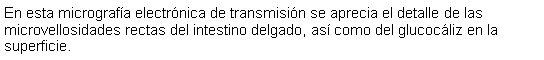 Cuadro de texto: En esta micrografa electrnica de transmisin se aprecia el detalle de las microvellosidades rectas del intestino delgado, as como del glucocliz en la superficie. 