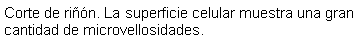 Cuadro de texto: Corte de rin. La superficie celular muestra una gran cantidad de microvellosidades. 