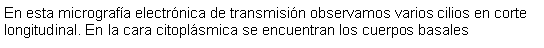 Cuadro de texto: En esta micrografa electrnica de transmisin observamos varios cilios en corte longitudinal. En la cara citoplsmica se encuentran los cuerpos basales