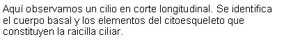 Cuadro de texto: Aqu observamos un cilio en corte longitudinal. Se identifica el cuerpo basal y los elementos del citoesqueleto que constituyen la raicilla ciliar. 