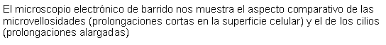 Cuadro de texto: El microscopio electrnico de barrido nos muestra el aspecto comparativo de las microvellosidades (prolongaciones cortas en la superficie celular) y el de los cilios (prolongaciones alargadas)