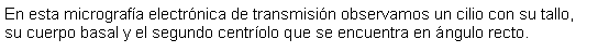 Cuadro de texto: En esta micrografa electrnica de transmisin observamos un cilio con su tallo, su cuerpo basal y el segundo centrolo que se encuentra en ngulo recto. 