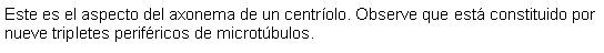 Cuadro de texto: Este es el aspecto del axonema de un centrolo. Observe que est constituido por nueve tripletes perifricos de microtbulos. 