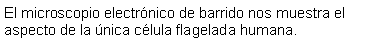 Cuadro de texto: El microscopio electrnico de barrido nos muestra el aspecto de la nica clula flagelada humana. 