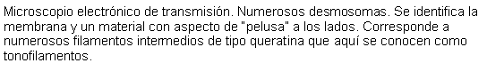 Cuadro de texto: Microscopio electrnico de transmisin. Numerosos desmosomas. Se identifica la membrana y un material con aspecto de pelusa a los lados. Corresponde a numerosos filamentos intermedios de tipo queratina que aqu se conocen como tonofilamentos.