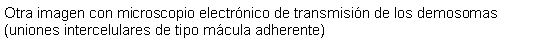 Cuadro de texto: Otra imagen con microscopio electrnico de transmisin de los demosomas (uniones intercelulares de tipo mcula adherente)