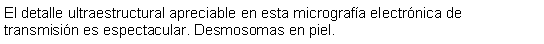 Cuadro de texto: El detalle ultraestructural apreciable en esta micrografa electrnica de transmisin es espectacular. Desmosomas en piel. 