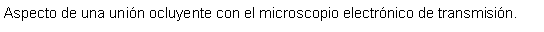 Cuadro de texto: Aspecto de una unin ocluyente con el microscopio electrnico de transmisin. 