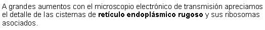 Cuadro de texto: A grandes aumentos con el microscopio electrnico de transmisin apreciamos el detalle de las cisternas de retculo endoplsmico rugoso y sus ribosomas asociados.  