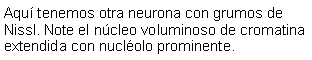 Cuadro de texto: Aqu tenemos otra neurona con grumos de Nissl. Note el ncleo voluminoso de cromatina extendida con nuclolo prominente. 