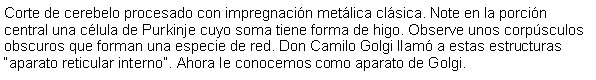 Cuadro de texto: Corte de cerebelo procesado con impregnacin metlica clsica. Note en la porcin central una clula de Purkinje cuyo soma tiene forma de higo. Observe unos corpsculos obscuros que forman una especie de red. Don Camilo Golgi llam a estas estructuras aparato reticular interno. Ahora le conocemos como aparato de Golgi. 