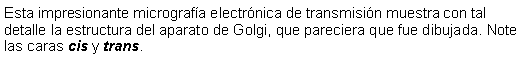 Cuadro de texto: Esta impresionante micrografía electrónica de transmisión muestra con tal detalle la estructura del aparato de Golgi, que pareciera que fue dibujada. Note las caras cis y trans. 
