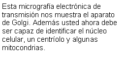 Cuadro de texto: Esta micrografía electrónica de transmisión nos muestra el aparato de Golgi. Además usted ahora debe ser capaz de identificar el núcleo celular, un centríolo y algunas mitocondrias. 
