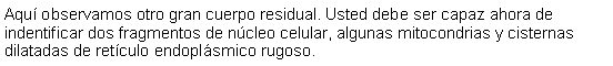 Cuadro de texto: Aqu observamos otro gran cuerpo residual. Usted debe ser capaz ahora de indentificar dos fragmentos de ncleo celular, algunas mitocondrias y cisternas dilatadas de retculo endoplsmico rugoso. 