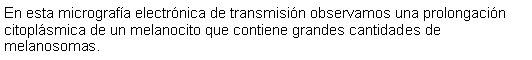 Cuadro de texto: En esta micrografa electrnica de transmisin observamos una prolongacin citoplsmica de un melanocito que contiene grandes cantidades de melanosomas. 
