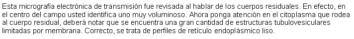 Cuadro de texto: Esta micrografa electrnica de transmisin fue revisada al hablar de los cuerpos residuales. En efecto, en el centro del campo usted identifica uno muy voluminoso. Ahora ponga atencin en el citoplasma que rodea al cuerpo residual, deber notar que se encuentra una gran cantidad de estructuras tubulovesiculares limitadas por membrana. Correcto, se trata de perfiles de retculo endoplsmico liso. 