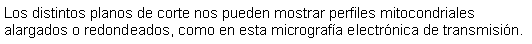 Cuadro de texto: Los distintos planos de corte nos pueden mostrar perfiles mitocondriales alargados o redondeados, como en esta micrografa electrnica de transmisin.  