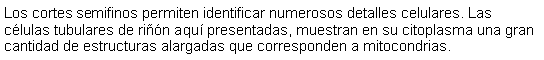 Cuadro de texto: Los cortes semifinos permiten identificar numerosos detalles celulares. Las clulas tubulares de rin aqu presentadas, muestran en su citoplasma una gran cantidad de estructuras alargadas que corresponden a mitocondrias.  