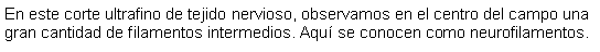 Cuadro de texto: En este corte ultrafino de tejido nervioso, observamos en el centro del campo una gran cantidad de filamentos intermedios. Aqu se conocen como neurofilamentos.