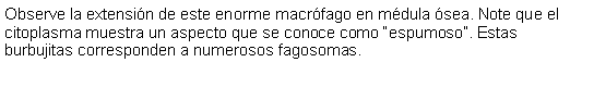 Cuadro de texto: Observe la extensin de este enorme macrfago en mdula sea. Note que el citoplasma muestra un aspecto que se conoce como espumoso. Estas burbujitas corresponden a numerosos fagosomas. 