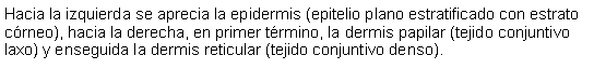 Cuadro de texto: Hacia la izquierda se aprecia la epidermis (epitelio plano estratificado con estrato crneo), hacia la derecha, en primer trmino, la dermis papilar (tejido conjuntivo laxo) y enseguida la dermis reticular (tejido conjuntivo denso).