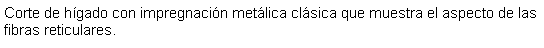 Cuadro de texto: Corte de hgado con impregnacin metlica clsica que muestra el aspecto de las fibras reticulares.