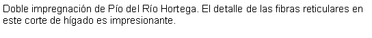 Cuadro de texto: Doble impregnacin de Po del Ro Hortega. El detalle de las fibras reticulares en este corte de hgado es impresionante.