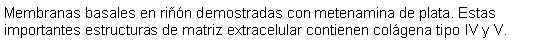 Cuadro de texto: Membranas basales en rin demostradas con metenamina de plata. Estas importantes estructuras de matriz extracelular contienen colgena tipo IV y V.