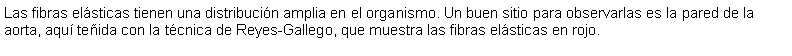 Cuadro de texto: Las fibras elsticas tienen una distribucin amplia en el organismo. Un buen sitio para observarlas es la pared de la aorta, aqu teida con la tcnica de Reyes-Gallego, que muestra las fibras elsticas en rojo.