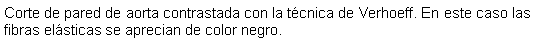 Cuadro de texto: Corte de pared de aorta contrastada con la tcnica de Verhoeff. En este caso las fibras elsticas se aprecian de color negro.