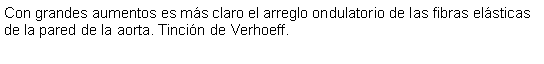 Cuadro de texto: Con grandes aumentos es ms claro el arreglo ondulatorio de las fibras elsticas de la pared de la aorta. Tincin de Verhoeff.