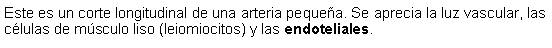 Cuadro de texto: Este es un corte longitudinal de una arteria pequea. Se aprecia la luz vascular, las clulas de msculo liso (leiomiocitos) y las endoteliales. 