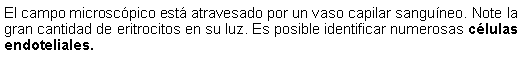 Cuadro de texto: El campo microscpico est atravesado por un vaso capilar sanguneo. Note la gran cantidad de eritrocitos en su luz. Es posible identificar numerosas clulas endoteliales. 