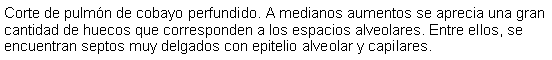 Cuadro de texto: Corte de pulmn de cobayo perfundido. A medianos aumentos se aprecia una gran cantidad de huecos que corresponden a los espacios alveolares. Entre ellos, se encuentran septos muy delgados con epitelio alveolar y capilares. 