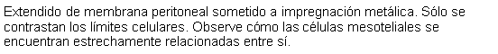 Cuadro de texto: Extendido de membrana peritoneal sometido a impregnacin metlica. Slo se contrastan los lmites celulares. Observe cmo las clulas mesoteliales se encuentran estrechamente relacionadas entre s. 