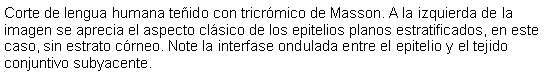 Cuadro de texto: Corte de lengua humana teido con tricrmico de Masson. A la izquierda de la imagen se aprecia el aspecto clsico de los epitelios planos estratificados, en este caso, sin estrato crneo. Note la interfase ondulada entre el epitelio y el tejido conjuntivo subyacente. 