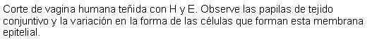 Cuadro de texto: Corte de vagina humana teida con H y E. Observe las papilas de tejido conjuntivo y la variacin en la forma de las clulas que forman esta membrana epitelial. 