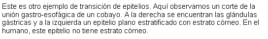 Cuadro de texto: Este es otro ejemplo de transicin de epitelios. Aqu observamos un corte de la unin gastro-esofgica de un cobayo. A la derecha se encuentran las glndulas gstricas y a la izquierda un epitelio plano estratificado con estrato crneo. En el humano, este epitelio no tiene estrato crneo. 