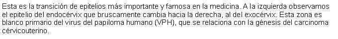 Cuadro de texto: Esta es la transicin de epitelios ms importante y famosa en la medicina. A la izquierda observamos el epitelio del endocrvix que bruscamente cambia hacia la derecha, al del exocrvix. Esta zona es blanco primario del virus del papiloma humano (VPH), que se relaciona con la gnesis del carcinoma crvicouterino. 