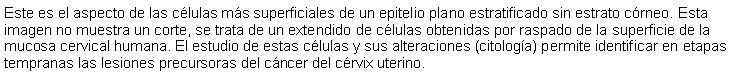 Cuadro de texto: Este es el aspecto de las clulas ms superficiales de un epitelio plano estratificado sin estrato crneo. Esta imagen no muestra un corte, se trata de un extendido de clulas obtenidas por raspado de la superficie de la mucosa cervical humana. El estudio de estas clulas y sus alteraciones (citologa) permite identificar en etapas tempranas las lesiones precursoras del cncer del crvix uterino. 