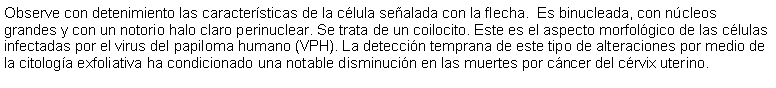 Cuadro de texto: Observe con detenimiento las características de la célula señalada con la flecha.  Es binucleada, con núcleos grandes y con un notorio halo claro perinuclear. Se trata de un coilocito. Este es el aspecto morfológico de las células infectadas por el virus del papiloma humano (VPH). La detección temprana de este tipo de alteraciones por medio de la citología exfoliativa ha condicionado una notable disminución en las muertes por cáncer del cérvix uterino. 
