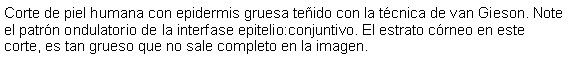 Cuadro de texto: Corte de piel humana con epidermis gruesa teido con la tcnica de van Gieson. Note el patrn ondulatorio de la interfase epitelio:conjuntivo. El estrato crneo en este corte, es tan grueso que no sale completo en la imagen. 