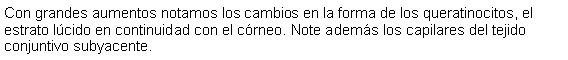 Cuadro de texto: Con grandes aumentos notamos los cambios en la forma de los queratinocitos, el estrato lcido en continuidad con el crneo. Note adems los capilares del tejido conjuntivo subyacente.  