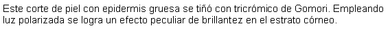 Cuadro de texto: Este corte de piel con epidermis gruesa se ti con tricrmico de Gomori. Empleando luz polarizada se logra un efecto peculiar de brillantez en el estrato crneo. 