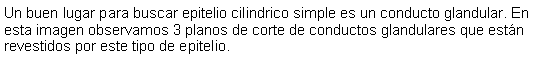 Cuadro de texto: Un buen lugar para buscar epitelio cilindrico simple es un conducto glandular. En esta imagen observamos 3 planos de corte de conductos glandulares que estn revestidos por este tipo de epitelio. 