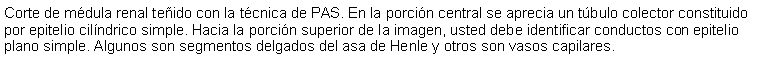 Cuadro de texto: Corte de mdula renal teido con la tcnica de PAS. En la porcin central se aprecia un tbulo colector constituido por epitelio cilndrico simple. Hacia la porcin superior de la imagen, usted debe identificar conductos con epitelio plano simple. Algunos son segmentos delgados del asa de Henle y otros son vasos capilares. 