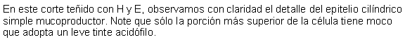 Cuadro de texto: En este corte teido con H y E, observamos con claridad el detalle del epitelio cilndrico simple mucoproductor. Note que slo la porcin ms superior de la clula tiene moco que adopta un leve tinte acidfilo. 